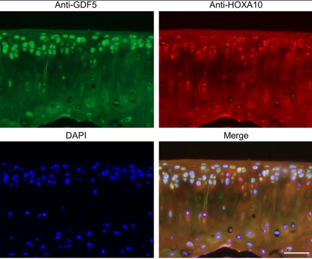 Immunofluorescent analysis of HOXA10 and GDF5 in articular cartilage.jpg